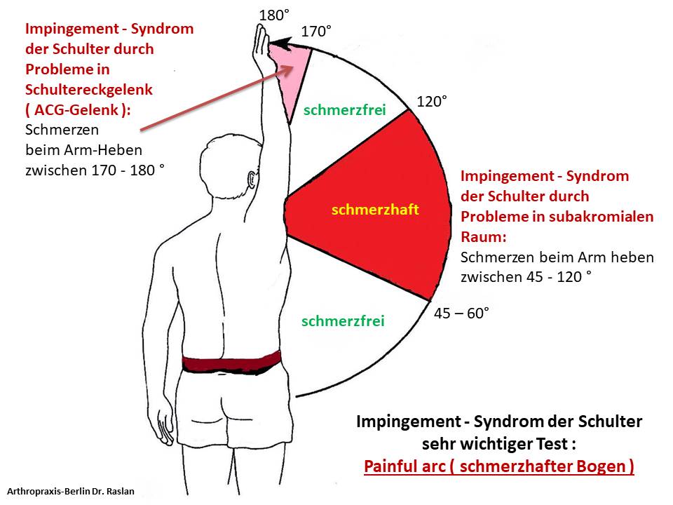 Impingement Syndrom Berlin Schulterspezialist Berlin Dr Raslan