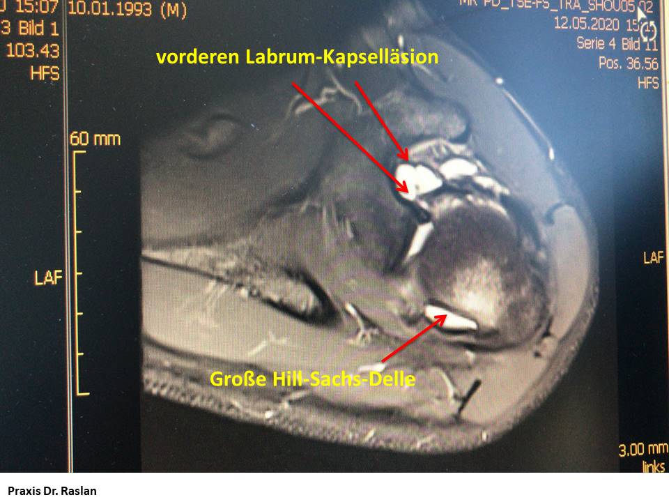 Orthopäde Berlin Dr Schulterluxation Dr Raslan Schulterspezialist Berlin 00