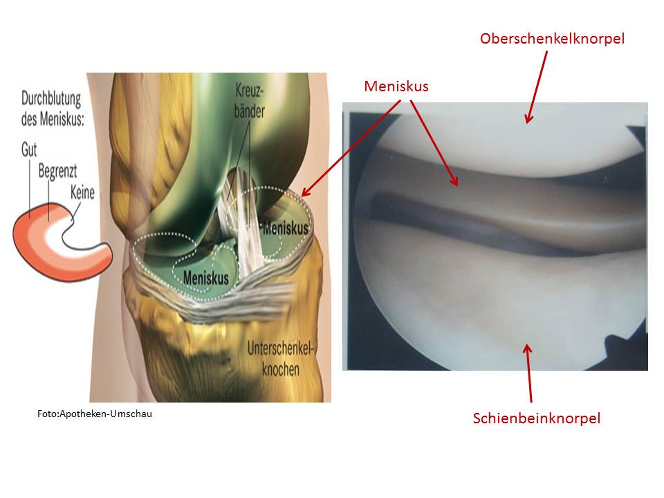 normale Meniskusanatomie