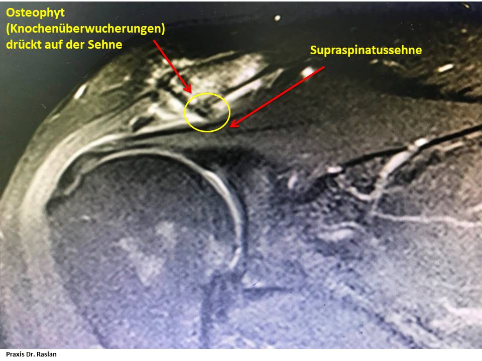 orthopäde Berlin Dr Raslan Schulterspezielist Kniespezialist Dr Raslan Berlin Fußspezielist Dr Raslan Berlin 3