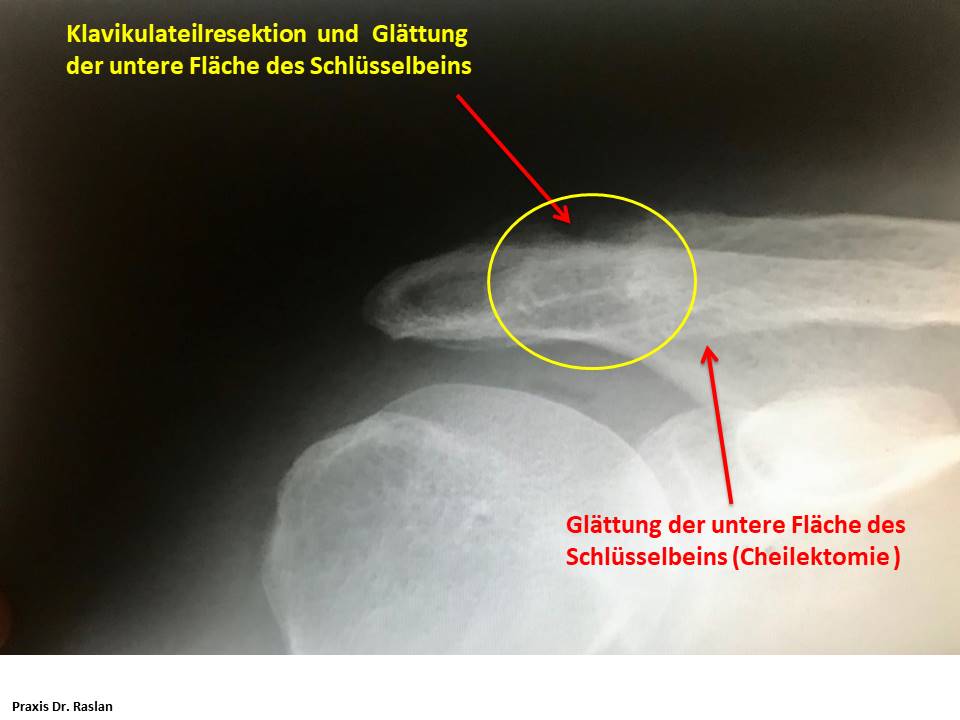 orthopäde Berlin Dr Raslan Schulterspezielist Kniespezialist Dr Raslan Berlin Fußspezielist Dr Raslan Berlin 5